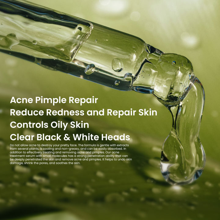 Rivaj%20UK%20Acne%20Treatment%20Serum%2030ml%20-%20Image%204