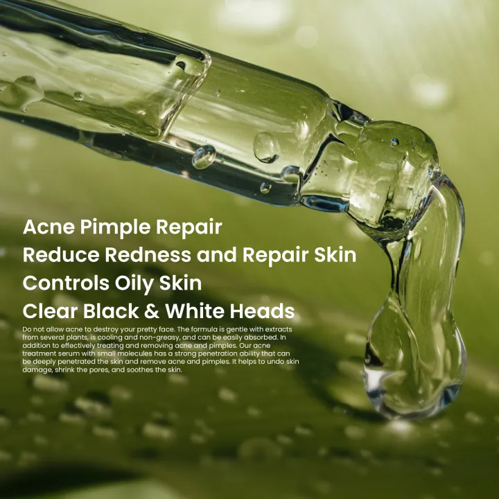 Rivaj%20UK%20Acne%20Treatment%20Serum%2030ml%20-%20Image%204