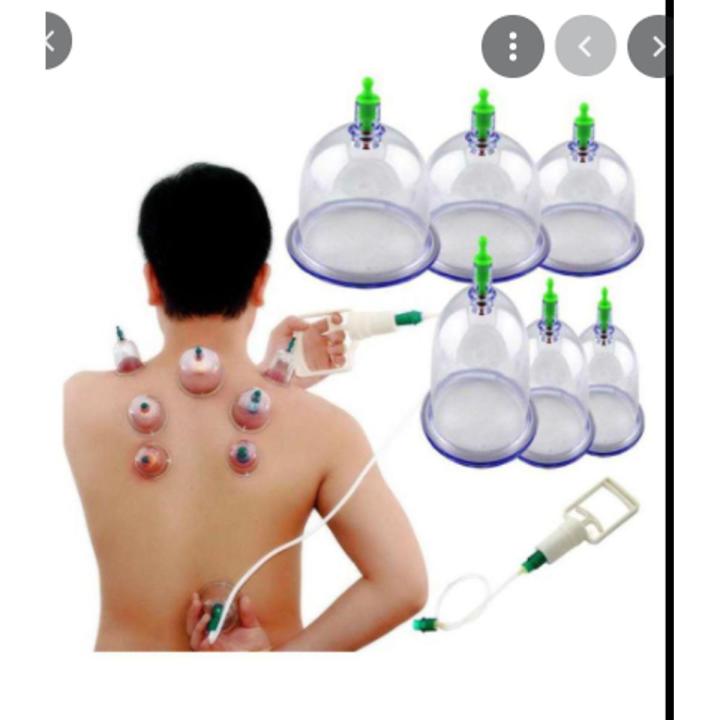 pack of 30 hijama cup of high quality for hajama without pump