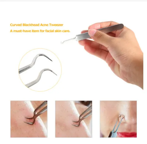 STAINLESS%20STEEL%20CURVED%20BLACKHEAD%20ACNE%20CLIP%20PIMPLE%20COMEDONE%20REMOVER%202PCS%20-%20Image%206