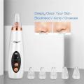 Blackhead Removal Machine Derma Suction 3 in 1 Black Head Remover Machine - Acne Pore Cleaner Vacuum Suction Tool Blackhead Removal On Nose Machine. 