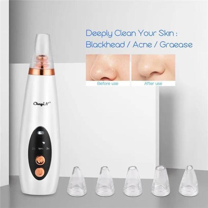 Blackhead Removal Machine Derma Suction 3 in 1 Black Head Remover Machine - Acne Pore Cleaner Vacuum Suction Tool Blackhead Removal On Nose Machine