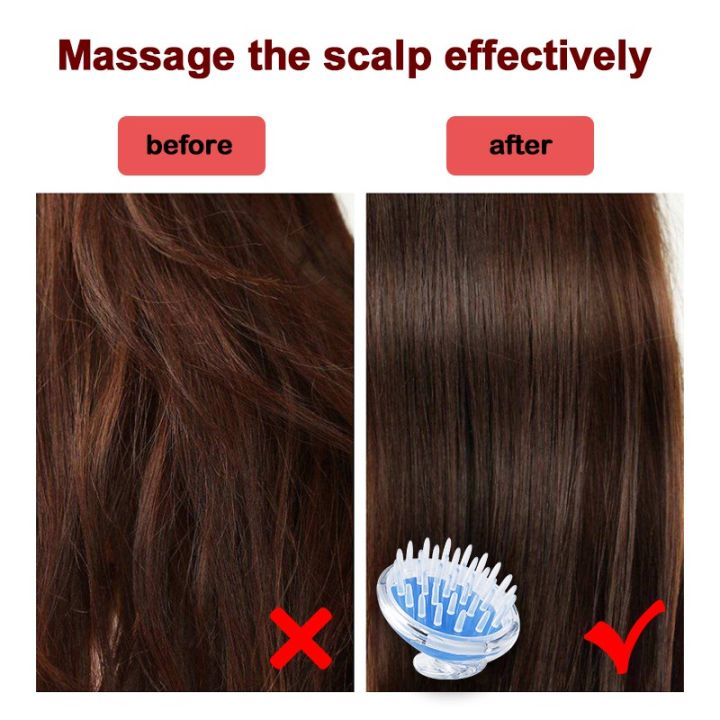 Silicone%20Shampoo%20Hair%20Wash%20Brush%20Hair%20scalp%20Massage%20Brush%20Head%20Anti%20Dandruff%20Haircare%20Massager%20Someday%20Silicone%20Comb%20Brush%20scalp%20Massager%20Bath%20-%20Image%204