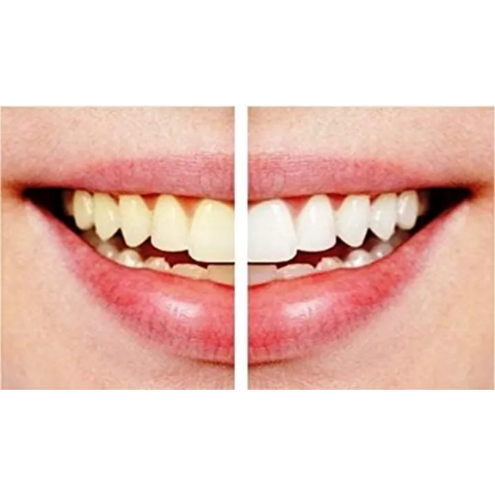 Pack%20of%202%20Dazzling%20White%20Professional%20Strength%20Teeth%20Whitening%20Pens%20%7C%20Hygienic%20&%20Easy%20to%20Use%20-%20Image%203