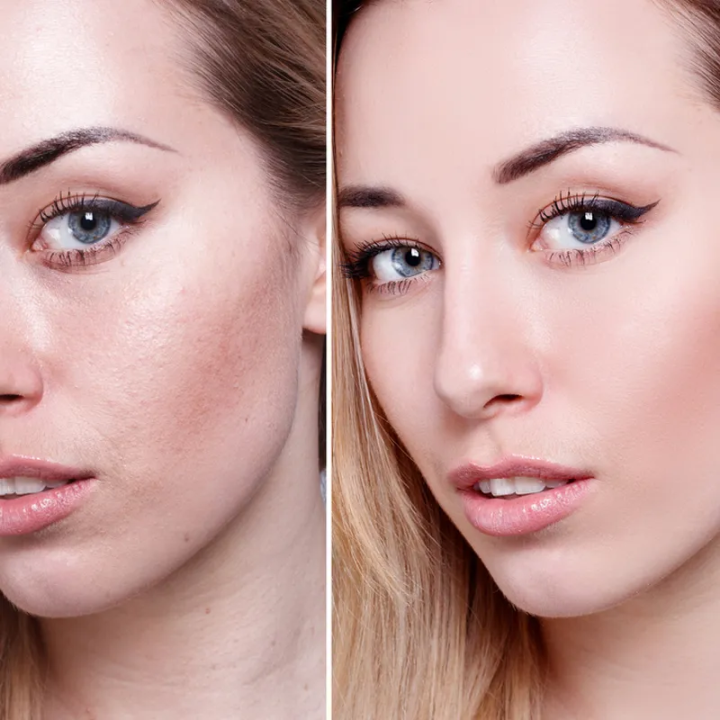 Face%20Fresh%20Gold%204%20in%201%20beauty%20pack%20(Cream,soap,serum%20and%20capsule)%20-%20Image%207