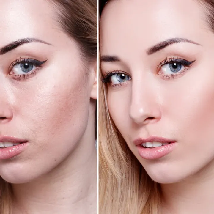 Face%20Fresh%20Gold%204%20in%201%20beauty%20pack%20(Cream,soap,serum%20and%20capsule)%20-%20Image%207