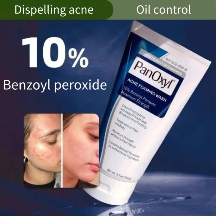 PanOxyl%20Acne%20Foaming%20Wash%2010%25%20Maximum%20Strength%201oz%20156ML%20-%20Image%207