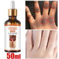 Lethe Ling Dark s Fast Whitening Serum Hand Elbows Knee Melanin Corrector Intense Stains Remover Products Beauty Care 50ml. 