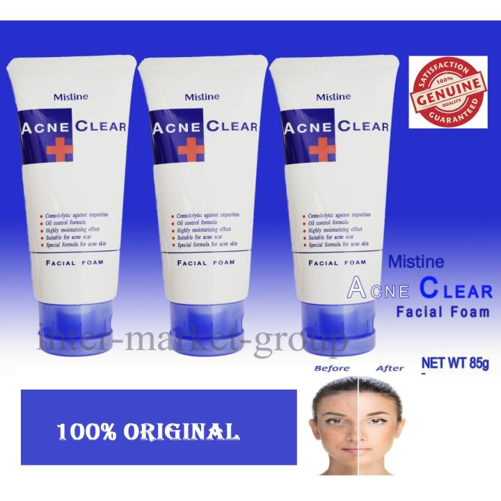 Mistine Acne Clear Face Wash Facial Foam 85 ml (Pack of 3)