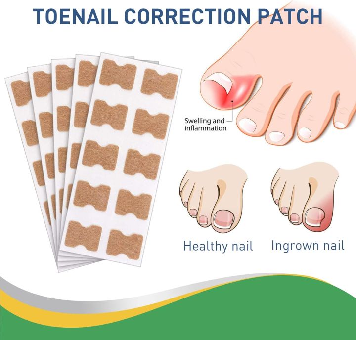 Royal%20Prestige%20Ingrown%20Toenail%20Pain%20Reliever%20Patches%20(30%20Patches)%20%E2%80%94%20Fast%20Relief,%20Toenail%20Correction%20Sticker,%20Toe%20Nail%20Treatment%20Strips%20ingrown%20toenail%20patches%20toenail%20pain%20reliever%20toenail%20correction%20sticker%20toe%20nail%20treatment%20foot%20care%20patch%20-%20Image%206