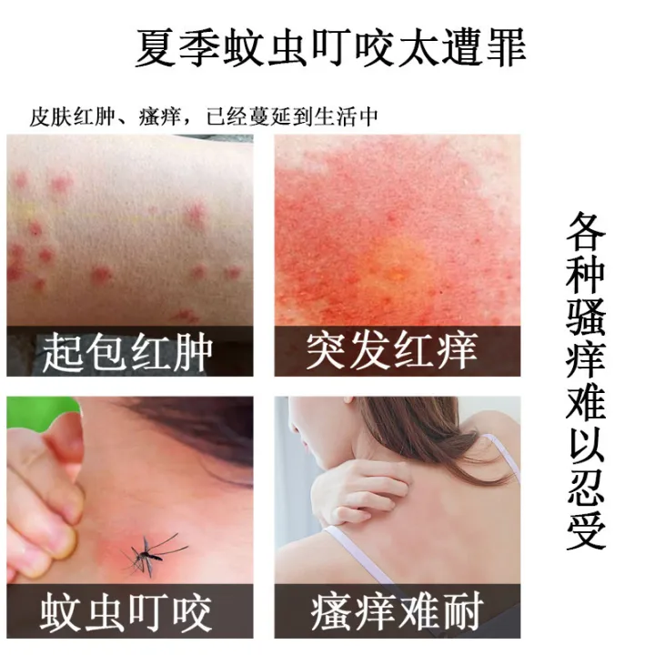 Hong%20Kong%20pharmacy%20fungus%20king%20skin%20care%20wormwood%20cream%20hand%20and%20foot%20care%20cream%20sulfur%20ointment%20manufacturers%20wholesale%20-%20Image%202