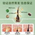 Yao Pin Anti-Hair Loss Essence, Hairline Nutrient Solution, Dense Hair Growth Liquid, Herbal Hair Nourishment. 