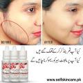 Permanent Hair Remover Lotion - 15 ml - 3 bottles complete course. 