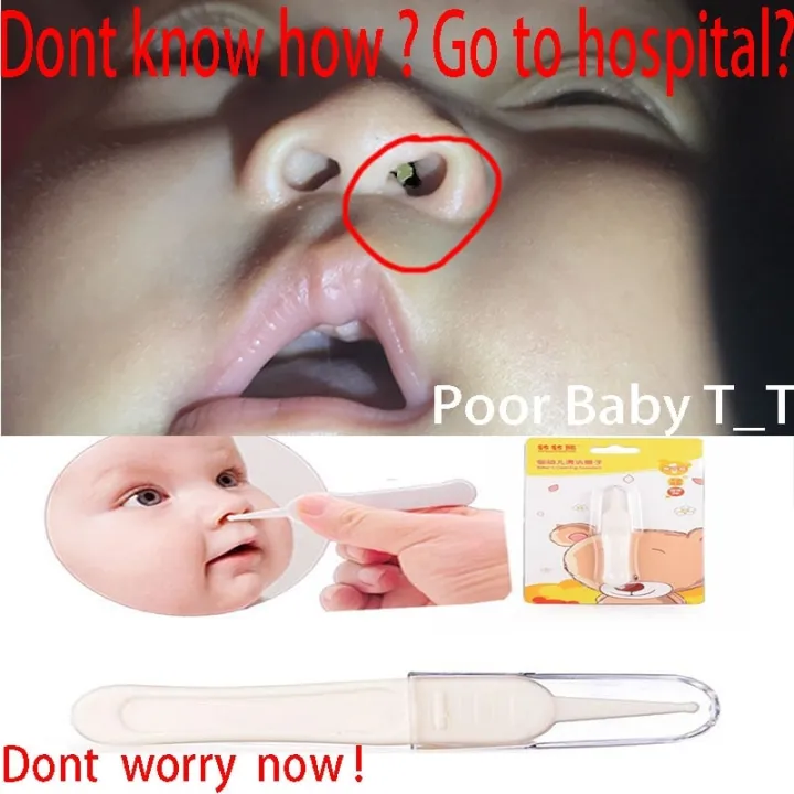 Baby%20Dig%20Booger%20Clip%20Infants%20Ear%20Nose%20Navel%20Clean%20Tools%20Kids%20Safety%20Tweezers%20Cleaning%20Forceps%20Toddler%20Nasal%20Cavity%20Care%20Supplies%20-%20Image%203