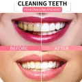 Baking Soda Viaty Vegetation Toothpaste Stain Smoke Removal Reduce Tooth Dirt Whitening Fight Bleeding Gums Toothpaste. 