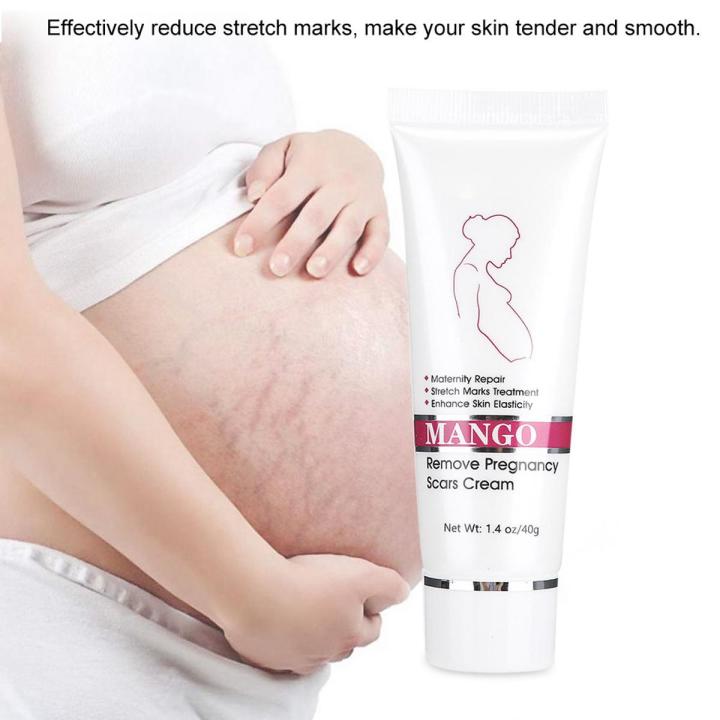 Stretch Marks Scar Removal Maternity Skin Body Repair Cream