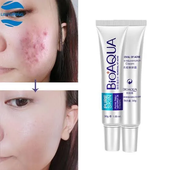 BIO%20AQUA%20Pure%20Skin%20Acne%20Removal%20Cream%2030g%20%E2%80%93%20Anti-Acne,%20Scar%20&%20Spot%20Treatment,%20Anti-Wrinkle%20Face%20Care%20for%20Blemishes%20&%20Marks%20-%20Image%202