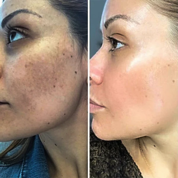 ActaWhite%20Cleanser%20%7C%20Brightening%20&%20Gentle%20Daily%20Face%20Wash%20for%20Healthy%20Skin%20%7C%2050ml%20-%20Image%202