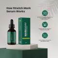 Markaway Stretch Mark Serum | Advanced Skin Repair Formula | Reduces Stretch Marks, Scars & Uneven Skin Tone 30ml. 