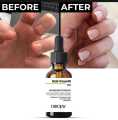 Nail Growth Serum 12% – Strengthening & Nourishing Formula with Biotin, Vitamin E & Keratin | 30ml. 