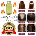 (200% Result) - Hair King Oil - Hair Growing Herbal Oil - GUARANTEED RESULT. 