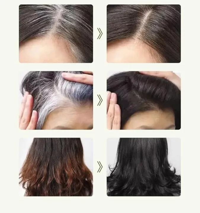 Apple%20Hair%20Color%20Dark%20Brown%20/%20Black%20Hair%20Dye%20Cream%20(30ml%20x%2010Pcs)%20%E2%80%93%20Natural%20Hair%20Color%20with%20No%20Scalp%20Touch,%20Long-Lasting%20Black,%20Lead-Free%20&%20Non-Toxic%20(quick%205%20min%20dye)%20-%20Image%207