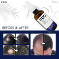 phone case FEG Organic Anti Hair Loss Hair Growth Treatment Oil For Thicker Long Hair  50ML. 