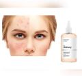 The Ordinary Glycolic Acid 7% Toning Solution Lightweight Liquid Provides Sun Protection – 240ml. 