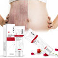 EFERO Repair Cream Removal Scar Stretch Marks Postpartum Maternity Skin Solution. 