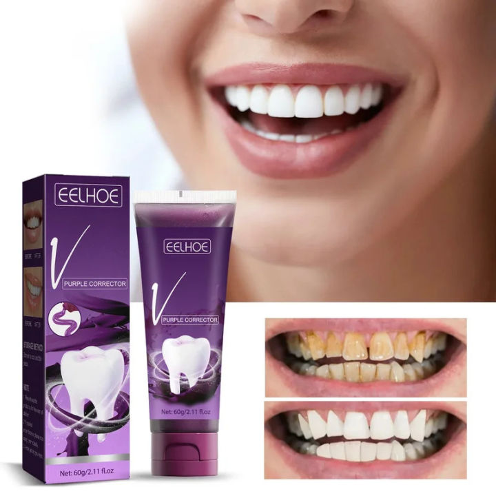 EELHOE Toothpaste Whitening Teeth Removes Coffee Smoke Stains Fresh Breath Oral Hygiene Care Toothpaste Fast and Free Shipping