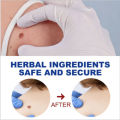Wart Remover Skin Pen Gel - All Natural Way - Painless & Non Surgical. 