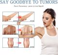 Lipoma Removal Cream | Advanced Lipoma Treatment Cream | Safe & Gentle Use. 