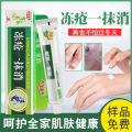 Frostbite wipe away 25g anti-frostbite cracked hands and feet hand and foot cream Moisturizing and moisturizing winter skin care cream. 