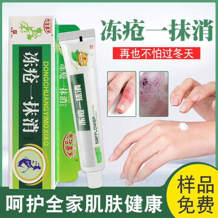 Frostbite%20wipe%20away%2025g%20anti-frostbite%20cracked%20hands%20and%20feet%20hand%20and%20foot%20cream%20Moisturizing%20and%20moisturizing%20winter%20skin%20care%20cream%20-%20Image%204