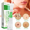Skin Tag Removal Body Mole Wart Remover Spot Marks Wart Remover Beauty Tools professional design. 