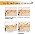 SEVICH 5PCS Blackhead Removal Deep Cleansing Skin Pore Mask 6g. 