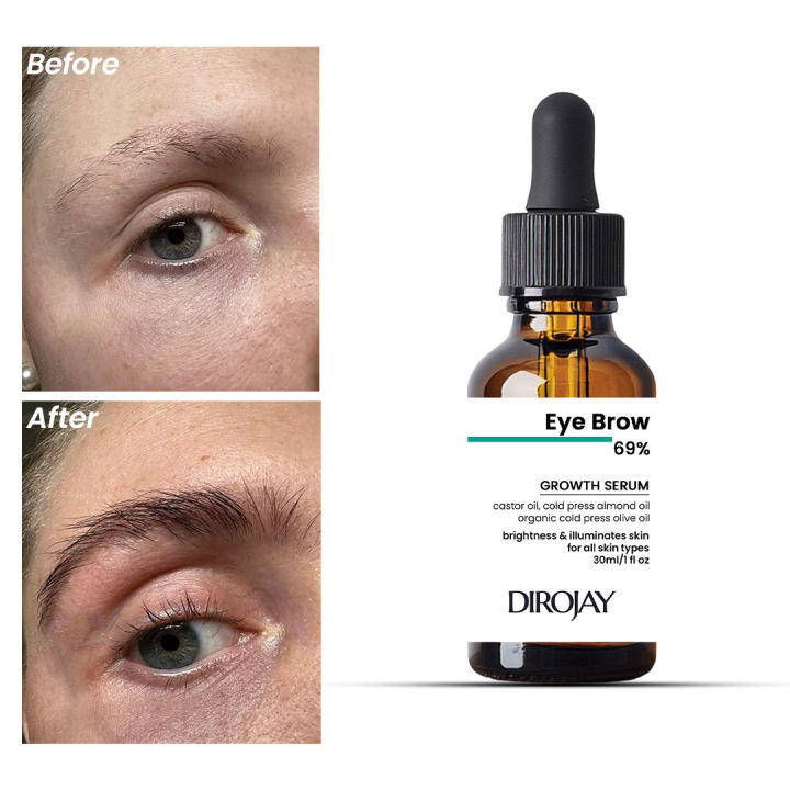 Eyebrow%20Growth%20Serum%2069%25%20%E2%80%93%20Natural%20Enhancer%20for%20Thicker,%20Fuller%20Brows%20%7C%2030ml%20-%20Image%202
