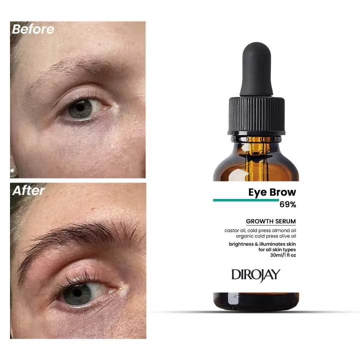 Eyebrow%20Growth%20Serum%2069%25%20%E2%80%93%20Natural%20Enhancer%20for%20Thicker,%20Fuller%20Brows%20%7C%2030ml%20-%20Image%202