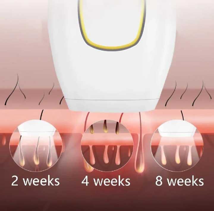 IPL%20Laser%20Hair%20Removal%20Machine%20-%20Permanent%20Female%20Hairs%20Removing%20Pulsed%20Light%20Electric%20Depilatory%20Device%20For%20Facial%20Body%20Bikini%20-%20Image%206