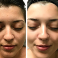 Lumexa Cream (NEW & IMPROVED Formula) | 30g. 