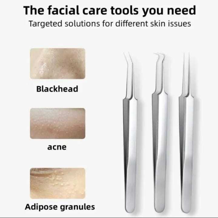Professional%20beauty%20tools%208Pc%20Whitehead%20&%20Blackhead%20Removal%20Tool%20Set%20%E2%80%93%20Premium%20Stainless%20Steel%20Facial%20Extractor%20Kit%20for%20Acne,%20Pimple%20&%20Comedone%20Removal%20%E2%80%93%20Professional%20Beauty%20Skin%20Care%20Tools%20for%20Face%20Cleaning%20&%20Treatment%20-%20Image%205