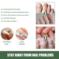 South Moon Toenail Repair Kit Cleansing Nail Nail Nail Thickening Hand & Foot Thickening Nail Repair Kit. 