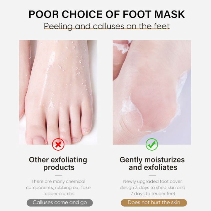 Foot%20mask,%20Exfoliating%20peel%20off%20mask,%20dead%20skin%20remover%201%20mask%20%7C%20Pack%20of%203%20-%20Image%204