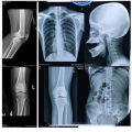 Wholesale X-ray Film blue simco 100 sheets per pack  size 10X12. 