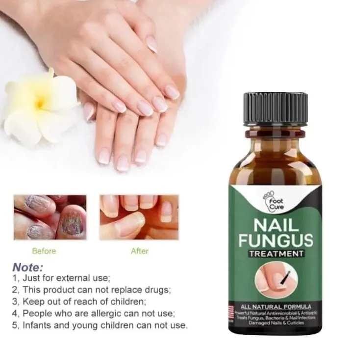Fast%20Nail%20Fungal%20Treatments%20Nail%20Repair%20Essences%20Serum%20Care%20Treatments%20Foot%20Nail%20Fungus%20Removal%20Gel%20Paronychia%20Onychomycosis%20-%20Image%204