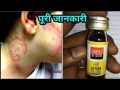 Sapat Dr Skin - Lotion 12ML For Skin Problems Eczema Rash Ringworm. 