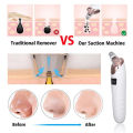 5 in 1 Electric Blackhead Remover & Whitehead Removal Machine – Derma Suction Blackhead Removal Machine | Electric Blackhead Remover Machine, Blackheads Remover, Blackheads Removal Tool, Acne Oil Remover Vacuum Suction Face Pore Cleaner | Electric Facial. 