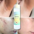 Klean Beauty - Exfoliating Super Toner 160 ml Glycolic Acid Toner for smooth, radiant skin Exfoliating toner for a brighter complexion Refreshing glycolic acid skincare for dead skin removal. 