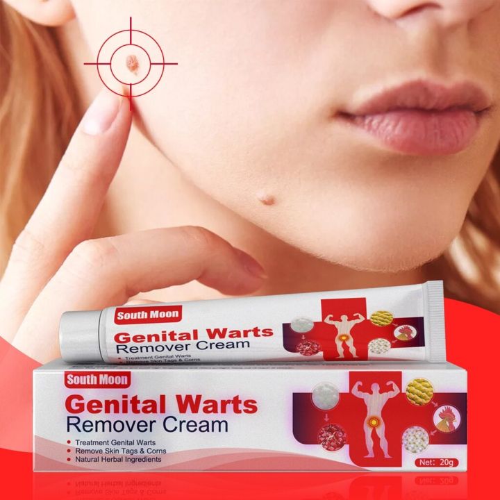 South%20Moon%20Wart%20Removing%20Ointment%20Anti%20Warts%20Ointment%20Hands%20Axillary%20Meat%20Particles%20Neck%20Filamentous%20Smooth%20Wart%20Remover%20Cream%20-%20Image%202