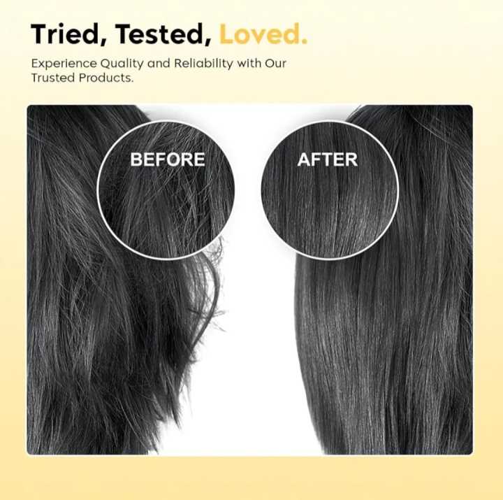 Scalp%20Applicator%20Comb,%20Oil%20Applicator%20Bottle,%20Portable%20Hair%20Oil%20Applicator%20for%20Scalp%20Massager%20and%20Hair%20Growth%20Care,%20Head%20Fluid%20Brush%20for%20Essential%20Oil%20Hair%20Treatment%20-%20Image%204